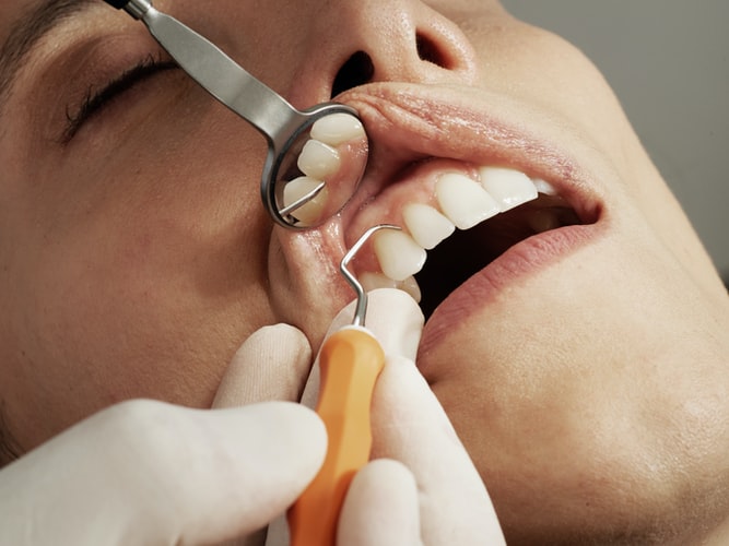 Soins dentaires en Hongrie, refaire ses dents pour 2 fois moins cher soins dentaires en Hongrie