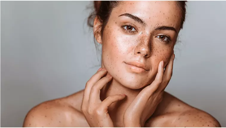 Les taches sur le visage est-ce un surplus de mélanine ? Découvrez des produits pour atténuer les taches d’hyperpigmentation. Les taches sur le visage est-ce un surplus de mélanine